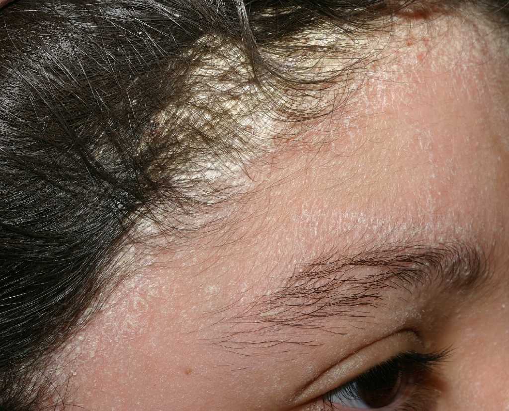 Антивозрастной уход за кожей - советы, особенности ухода за возрастной кожей