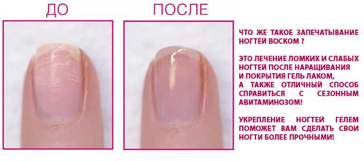 Что делать для укрепления ногтей: виды процедуры- beauty hub