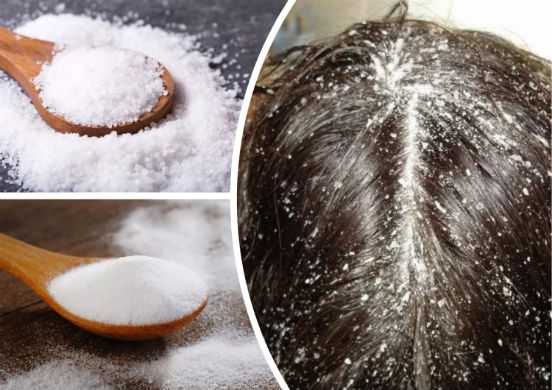 Соль для роста и от выпадения волос – скраб, спрей и маски
