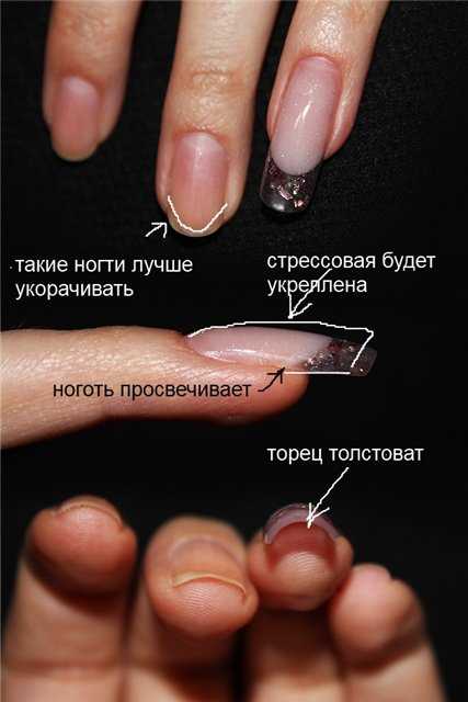 Почему отслаивается гель-лак от натуральных ногтей полностью пленкой вместе с базой и на кончиках, что делать, чтобы этого не происходило быстро, и причины отслойки