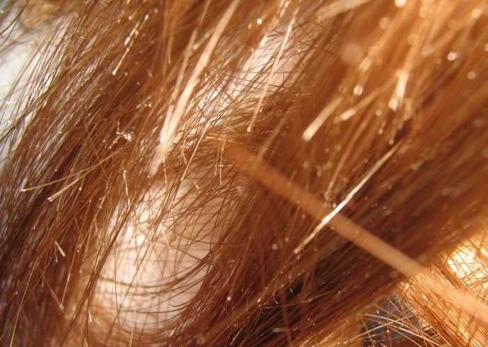 15 отличных питательных масок для волос в домашних условиях