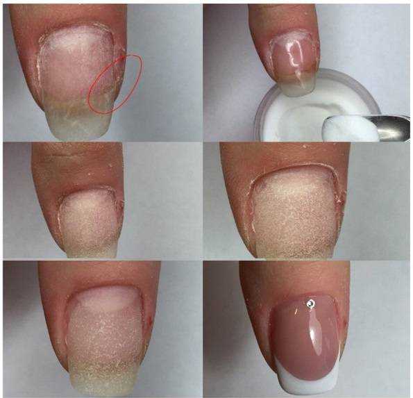 Моделирование ногтей акрилом: о чем нужно знать новичку • журнал nails