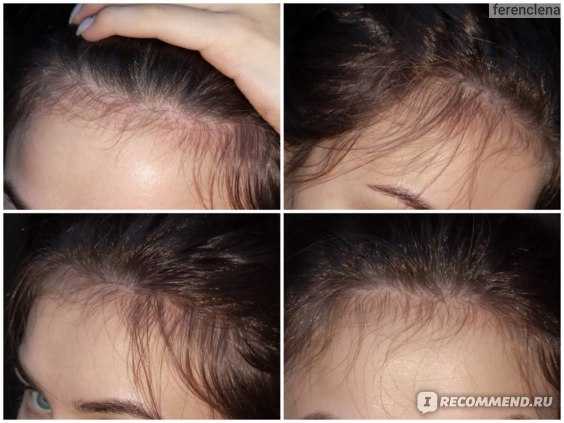 Масло усьмы для волос: польза и вред, применение в качестве масок для усиления роста
