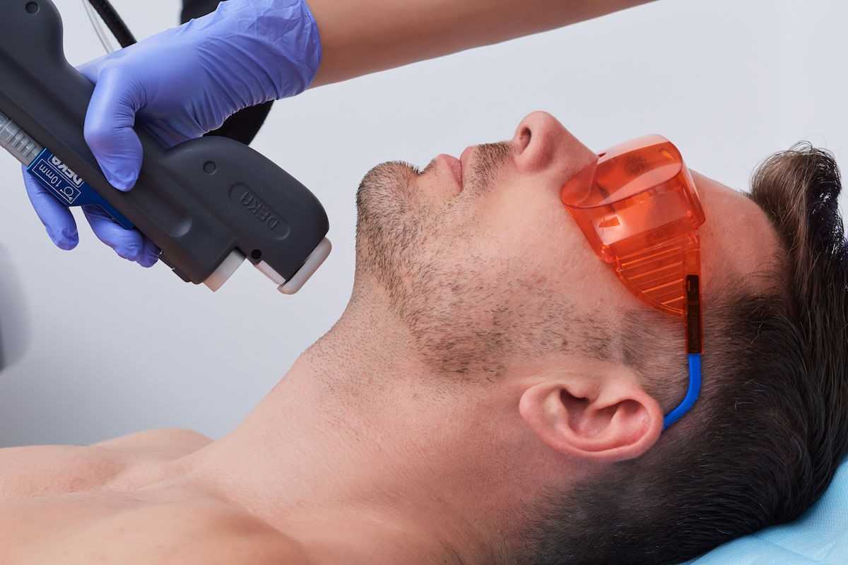 Мужская эпиляция: 5 эффективных способов удаления волос у мужчин