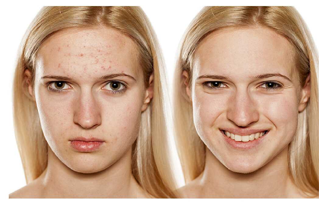 Уход за кожей лица летом: советы косметолога