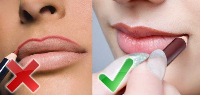 Филлеры для увеличения губ
