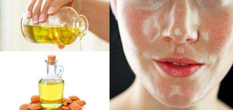Камфорное масло — восточный секрет здоровой кожи лица и роскошной шевелюры
