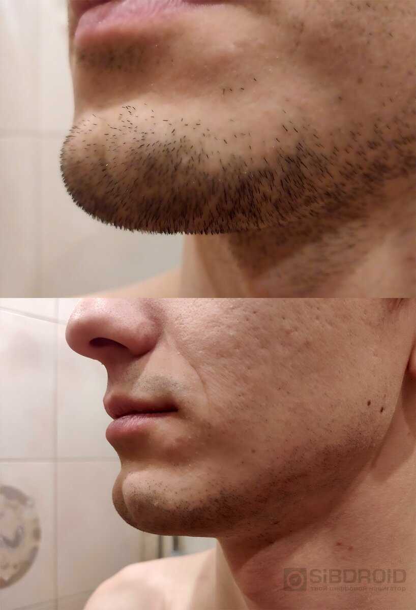 После бритья видно усы