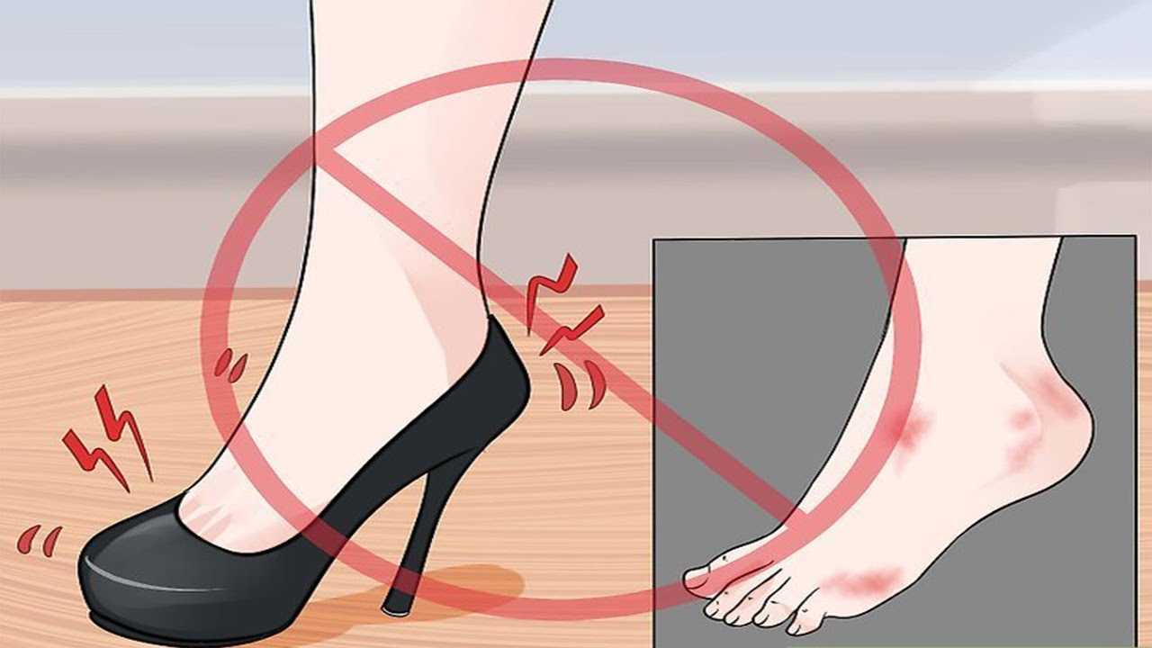 Мозоли: 7 хитростей, чтобы обувь не натирала