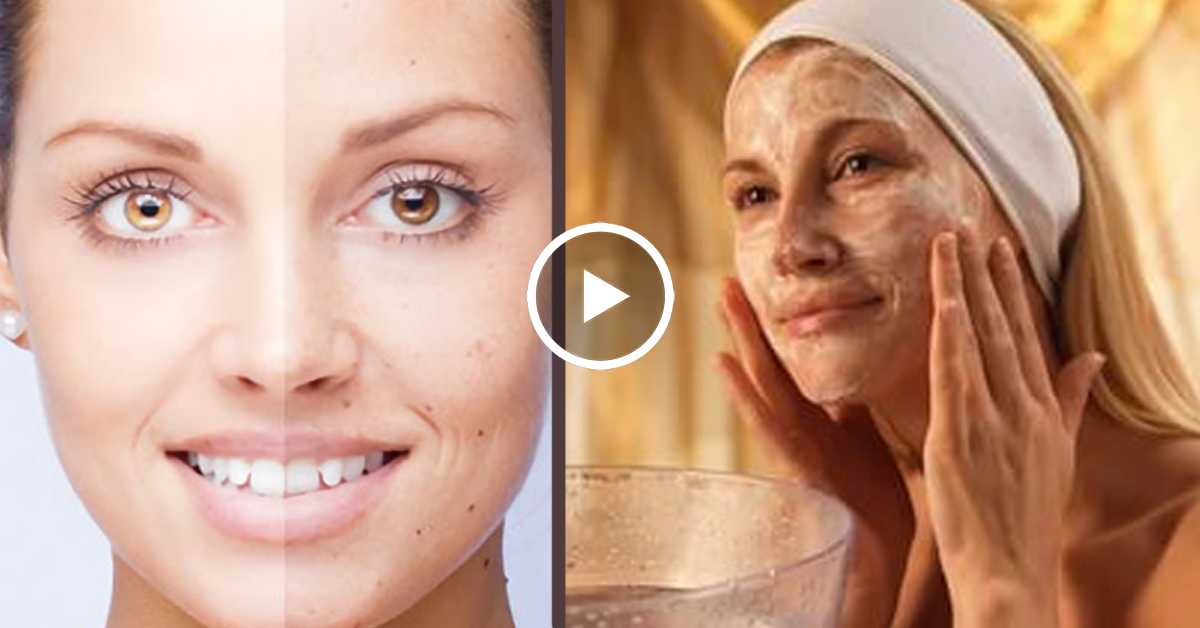 Как улучшить цвет кожи лица