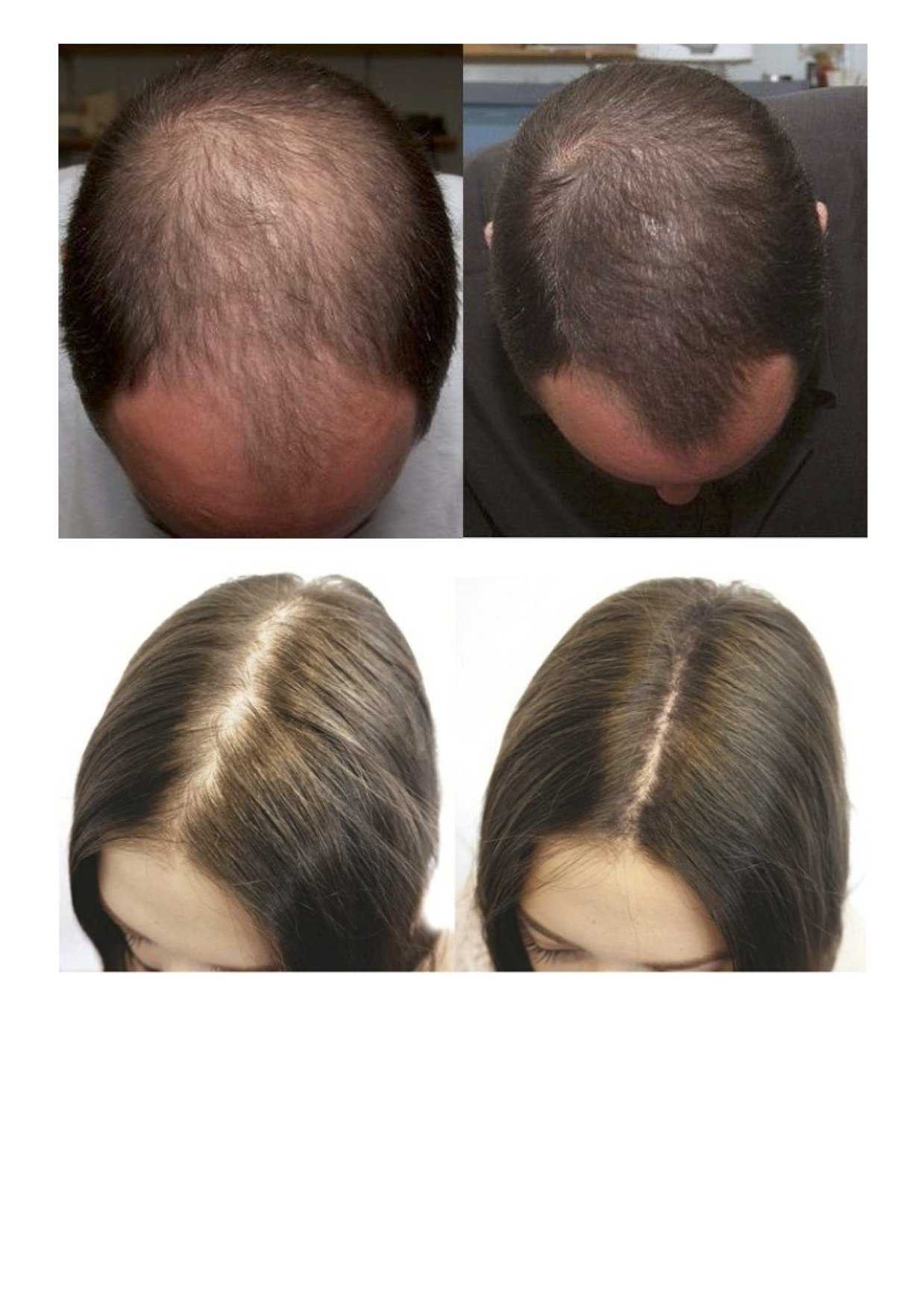 Сыворотка andrea hair growth essence (андреа) для роста волос: инструкция по применению и эффект от использования