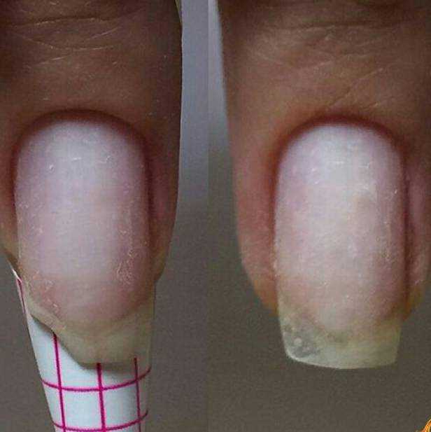 Почему гель на ногтях отслаивается. почему отслаивается гель-лак от ногтей: причины и особенности | школа красоты